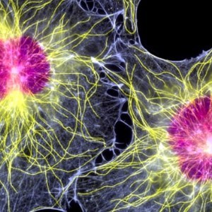 SpinalCyte Reports Success in Human Clinical Trials of CybroCell 