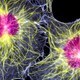 SpinalCyte Reports Success in Human Clinical Trials of CybroCell 
